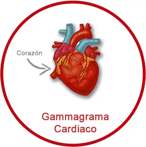 Gammagrama Cardiaco