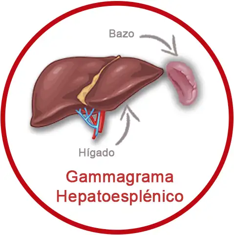 Gammagrama Hepatoesplénico