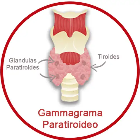 Gammagrama Paratoriodeo