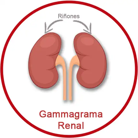 Gammagrama Renal