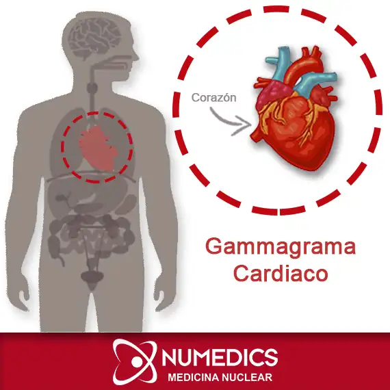 Gammagrama Cardíaco